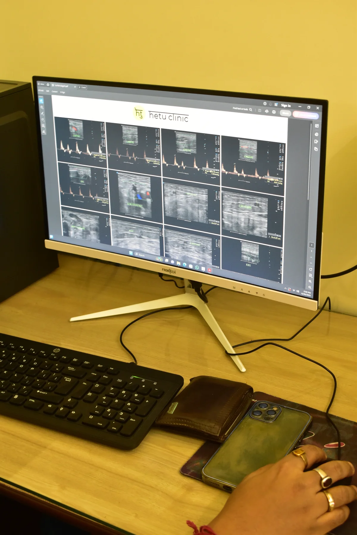 Radiology second opinion at Hetu Clinic